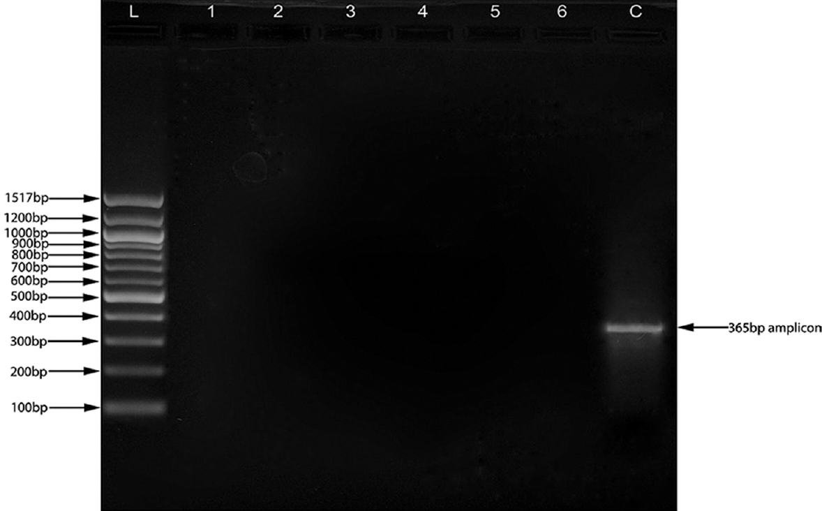 Polymerase chain reaction for the detection of RepH1A replicon. All six isolates were found to be negative for the RepH1A replicon, whereas plasmid from the Salmonella enterica serovar Typhi CT18 produced a fine band of 365 bp representative of RepH1A replicon. L: Ladder, Lane 1-6: Test plasmid DNA, C: plasmid from Salmonella enterica serovar Typhi CT18.